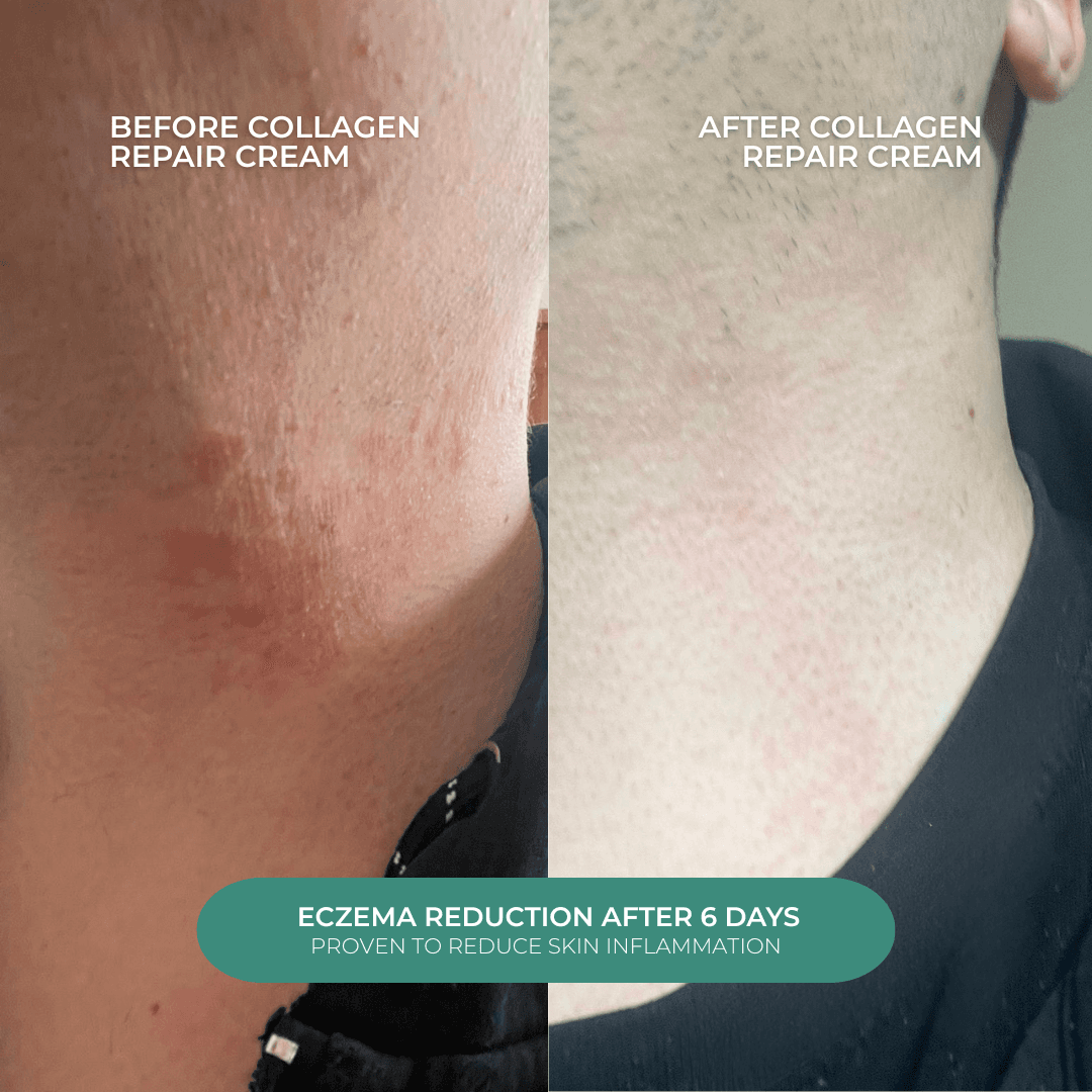 Bonneheure Collagen Repair Set thumbnail 3